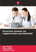 Cover: Enxertos osseos na regeneracao periodontal - Edicoes Nosso Conhecimento