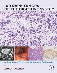 Abbildung von: 100 Rare Tumors of the Digestive System - Elsevier