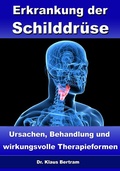 Cover: Erkrankung der Schilddr&uuml;se - Ursachen, Behandlung und wirkungsvolle Therapieformen - JoelNoah S.A.