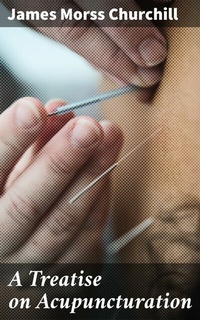 Abbildung von: A Treatise on Acupuncturation - Good Press