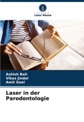 Cover: Laser in der Parodontologie - Verlag Unser Wissen