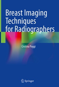 Abbildung von: Breast Imaging Techniques for Radiographers - Springer