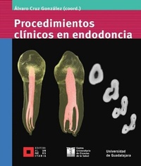 Abbildung von: Procedimientos clínicos en endodoncia - Editorial Universidad de Guadalajara