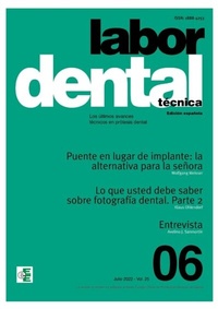 Abbildung von: Labor Dental Técnica Nº6 Vol.25 - Ediciones Especializadas Europeas