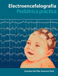 Abbildung von: Electroencefalografía Pediatría Práctica - Distribuna Editorial Médica
