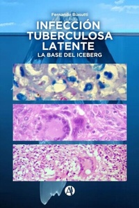 Abbildung von: Infección Tuberculosa Latente, la base del iceberg - Editorial Autores de Argentina