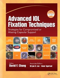 Enlarge image Cover: Advanced IOL Fixation Techniques - CRC Press