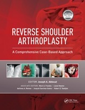 Cover: Reverse Shoulder Arthroplasty - CRC Press