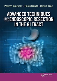 Abbildung von: Advanced Techniques for Endoscopic Resection in the GI Tract - Taylor & Francis