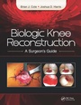 Cover: Biologic Knee Reconstruction - CRC Press