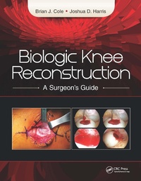 Enlarge image Cover: Biologic Knee Reconstruction - CRC Press