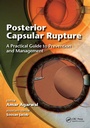Cover: Posterior Capsular Rupture - CRC Press