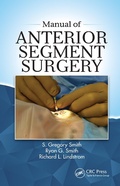 Cover: Manual of Anterior Segment Surgery - CRC Press
