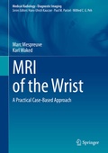 Cover: MRI of the Wrist - Springer