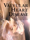 Cover: Valvular Heart Disease - CRC Press