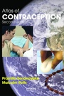 Cover: Atlas of Contraception - CRC Press