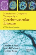 Cover: Multidetector Computed Tomography in Cerebrovascular Disease - CRC Press