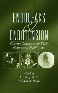 Enlarge image Cover: Endoleaks and Endotension - CRC Press