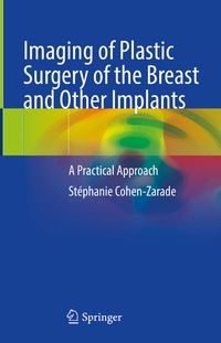 Abbildung von: Imaging of Plastic Surgery of the Breast and Other Implants - Springer