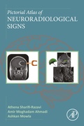 Abbildung von: Pictorial Atlas of Neuroradiological Signs - Academic Press
