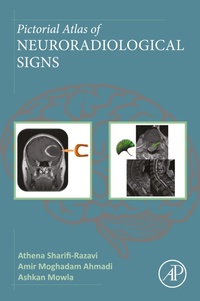 Abbildung von: Pictorial Atlas of Neuroradiological Signs - Academic Press