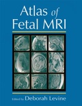 Cover: Atlas of Fetal MRI - CRC Press