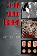 Cover: Acute Aortic Disease - CRC Press