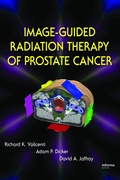 Cover: Image-Guided Radiation Therapy of Prostate Cancer - CRC Press