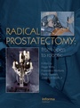 Cover: Radical Prostatectomy - CRC Press