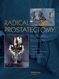Cover: Radical Prostatectomy - CRC Press