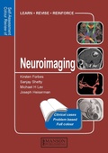 Cover: Neuroimaging - CRC Press