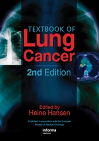 Enlarge image Cover: Textbook of Lung Cancer - CRC Press