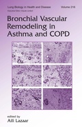 Bild: Bronchial Vascular Remodeling in Asthma and COPD - CRC Press
