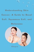 Cover: Understanding Skin Cancer: A Guide to Basal Cell, Squamous Cell, and Melanoma - tredition