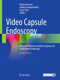 Abbildung von: Video Capsule Endoscopy - Springer
