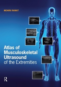 Abbildung von: Atlas of Musculoskeletal Ultrasound of the Extremities - Routledge
