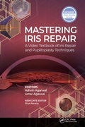 Cover: Mastering Iris Repair - CRC Press