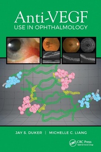 Enlarge image Cover: Anti-VEGF Use in Ophthalmology - CRC Press