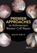 Cover: Premier Approaches to Arthroscopic Rotator Cuff Repair - CRC Press