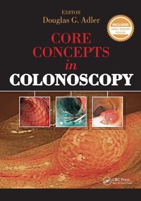 Abbildung von: Core Concepts in Colonoscopy - CRC Press