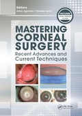 Cover: Mastering Corneal Surgery - CRC Press