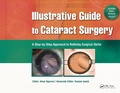Cover: Illustrative Guide to Cataract Surgery - CRC Press