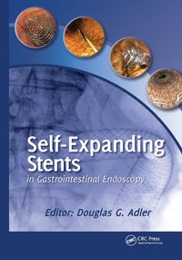 Abbildung von: Self-Expanding Stents in Gastrointestinal Endoscopy - CRC Press