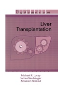 Cover: Liver Transplantation - CRC Press