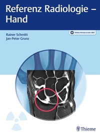 Abbildung von: Referenz Radiologie - Hand - Thieme