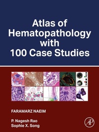 Abbildung von: Atlas of Hematopathology with 100 Case Studies - Academic Press