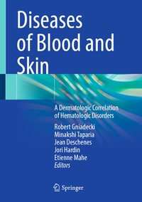 Abbildung von: Diseases of Blood and Skin - Springer