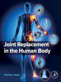 Abbildung von: Joint Replacement in the Human Body - Academic Press