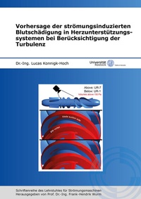 Abbildung von: Vorhersage der strömungsinduzierten Blutschädigung in Herzunterstützungssystemen bei Berücksichtigung der Turbulenz - Shaker