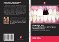 Cover: Avancos em procedimentos cirurgicos de implantes - Edicoes Nosso Conhecimento